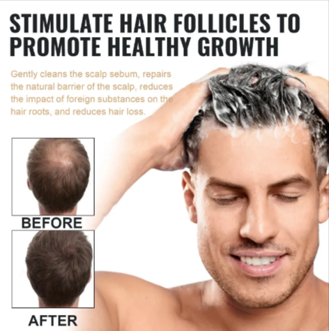 Root Activating Shampoo